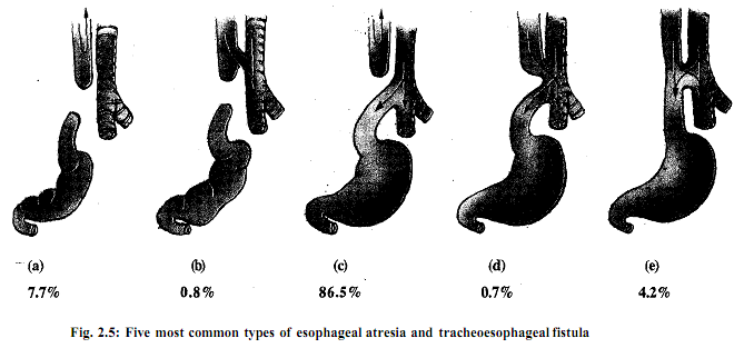 1999_oesophagus and stomach.png